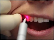 Лазеротерапия в стоматологии